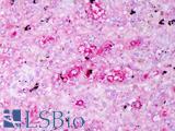 IL-10 Antibody - Anti-IL-10 antibody IHC of human spleen, macrophages. Immunohistochemistry of formalin-fixed, paraffin-embedded tissue after heat-induced antigen retrieval. Antibody concentration 5 ug/ml.