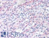 IL10RA Antibody - Human Spleen: Formalin-Fixed, Paraffin-Embedded (FFPE)
