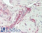 IL11 Antibody - Human Uterus, Vessels: Formalin-Fixed, Paraffin-Embedded (FFPE)