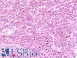 IL15 Antibody - Anti-IL15 antibody IHC staining of human tonsil. Immunohistochemistry of formalin-fixed, paraffin-embedded tissue after heat-induced antigen retrieval. Antibody concentration 10 ug/ml.