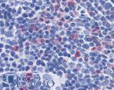 IL17 Antibody - Anti-IL-17 antibody IHC of mouse spleen. Immunohistochemistry of formalin-fixed, paraffin-embedded tissue after heat-induced antigen retrieval. Antibody concentration 10 ug/ml.