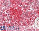 IL1RN Antibody - Human Spleen: Formalin-Fixed, Paraffin-Embedded (FFPE)
