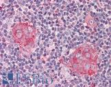 IL21 Receptor Antibody - Anti-IL21 Receptor antibody IHC of human thymus. Immunohistochemistry of formalin-fixed, paraffin-embedded tissue after heat-induced antigen retrieval. Antibody concentration 5 ug/ml.