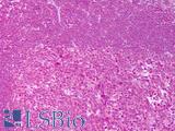 IL4 Antibody - Anti-IL-4 antibody IHC of human tonsil. Immunohistochemistry of formalin-fixed, paraffin-embedded tissue after heat-induced antigen retrieval. Antibody concentration 5 ug/ml.