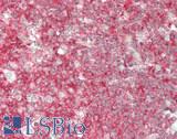 IL5 Antibody - Human Tonsil: Formalin-Fixed, Paraffin-Embedded (FFPE)