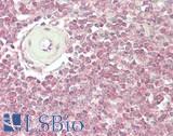 IL7R / CD127 Antibody - Human Spleen: Formalin-Fixed, Paraffin-Embedded (FFPE)