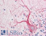 INA / Alpha Internexin Antibody - Anti-INA / Alpha Internexin antibody IHC staining of human brain, cerebellum. Immunohistochemistry of formalin-fixed, paraffin-embedded tissue after heat-induced antigen retrieval. Antibody dilution 1:100.