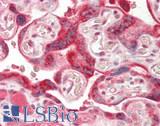 INHBA / Inhibin Beta A Antibody - Human Placenta: Formalin-Fixed, Paraffin-Embedded (FFPE)