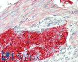 INHBB / Inhibin Beta B Antibody - Human Uterus, Vessel: Formalin-Fixed, Paraffin-Embedded (FFPE)