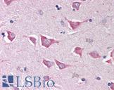 IPAF / NLRC4 Antibody - Anti-NLRC4 antibody IHC of human brain, cortex. Immunohistochemistry of formalin-fixed, paraffin-embedded tissue after heat-induced antigen retrieval. Antibody concentration 5 ug/ml.