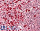 IRAK3 / IRAKM / IRAK-M Antibody - Human Spleen: Formalin-Fixed, Paraffin-Embedded (FFPE)