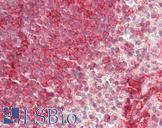 ITGAL / CD11a Antibody - Anti-LFA-1 / CD11a antibody IHC staining of human spleen. Immunohistochemistry of formalin-fixed, paraffin-embedded tissue after heat-induced antigen retrieval. Antibody dilution 1:100.