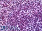 ITGAL / CD11a Antibody - Anti-ITGAL / CD11a antibody IHC of human spleen. Immunohistochemistry of formalin-fixed, paraffin-embedded tissue after heat-induced antigen retrieval. Antibody concentration 3.75 ug/ml.