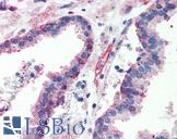ITGB1 / Integrin Beta 1 / CD29 Antibody - Anti-Integrin Beta 1 antibody IHC of human prostate. Immunohistochemistry of formalin-fixed, paraffin-embedded tissue after heat-induced antigen retrieval. Antibody concentration 10 ug/ml.