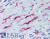 ITGB2 / CD18 Antibody - Anti-ITGB2 / CD18 antibody IHC of human brain, cerebellum. Immunohistochemistry of formalin-fixed, paraffin-embedded tissue after heat-induced antigen retrieval. Antibody concentration 10 ug/ml.