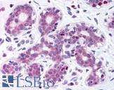 ITIH1 Antibody - Anti-Estrogen Receptor antibody IHC of human breast. Immunohistochemistry of formalin-fixed, paraffin-embedded tissue after heat-induced antigen retrieval. Antibody dilution 1:800.