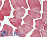 KBTBD13 Antibody - Anti-KBTBD13 antibody IHC staining of human skeletal muscle. Immunohistochemistry of formalin-fixed, paraffin-embedded tissue after heat-induced antigen retrieval. Antibody dilution 1:100.