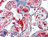 KIAA0319 Antibody - Anti-KIAA0319 antibody IHC staining of human placenta. Immunohistochemistry of formalin-fixed, paraffin-embedded tissue after heat-induced antigen retrieval. Antibody concentration 5 ug/ml.