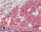 KLHL38 Antibody - Human Tonsil: Formalin-Fixed, Paraffin-Embedded (FFPE)