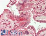 LAMA5 / Laminin Alpha 5 Antibody - Human Placenta: Formalin-Fixed, Paraffin-Embedded (FFPE)
