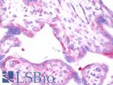 LAMB3 / Laminin Beta 3 Antibody - Anti-LAMB3 / Laminin Beta 3 antibody IHC staining of human placenta. Immunohistochemistry of formalin-fixed, paraffin-embedded tissue after heat-induced antigen retrieval.