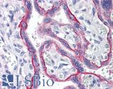 LANO / LRRC1 Antibody - Anti-LRRC1 / LANO antibody IHC of human placenta. Immunohistochemistry of formalin-fixed, paraffin-embedded tissue after heat-induced antigen retrieval. Antibody concentration 5 ug/ml.