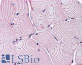 LDB3 / ZASP Antibody - Anti-LDB3 antibody IHC of human skeletal muscle. Immunohistochemistry of formalin-fixed, paraffin-embedded tissue after heat-induced antigen retrieval. Antibody concentration 3.75 ug/ml.
