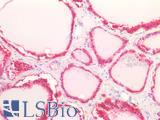 LDHB / Lactate Dehydrogenase B Antibody - Human Thyroid: Formalin-Fixed, Paraffin-Embedded (FFPE)