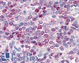 Leukotriene B4 Receptor / BLT1 Antibody - Anti-Leukotriene B4 Receptor antibody IHC of human spleen, red pulp. Immunohistochemistry of formalin-fixed, paraffin-embedded tissue after heat-induced antigen retrieval.