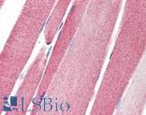 LGI4 Antibody - Anti-LGI4 antibody IHC of human skeletal muscle. Immunohistochemistry of formalin-fixed, paraffin-embedded tissue after heat-induced antigen retrieval. Antibody concentration 5 ug/ml.
