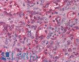 LHX1 Antibody - Anti-LHX1 antibody IHC of human spleen. Immunohistochemistry of formalin-fixed, paraffin-embedded tissue after heat-induced antigen retrieval. Antibody concentration 5 ug/ml.  This image was taken for the unconjugated form of this product. Other forms have not been tested.