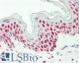 LHX6 Antibody - Anti-LHX6 antibody IHC staining of human skin. Immunohistochemistry of formalin-fixed, paraffin-embedded tissue after heat-induced antigen retrieval. Antibody dilution 1:75.