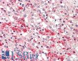 LIPA / Lysosomal Acid Lipase Antibody - Human Spleen: Formalin-Fixed, Paraffin-Embedded (FFPE)