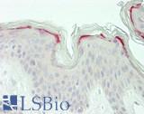 LMO7 Antibody - Human Skin: Formalin-Fixed, Paraffin-Embedded (FFPE)