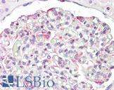 LMX1B Antibody - Anti-LMX1B antibody IHC staining of human kidney. Immunohistochemistry of formalin-fixed, paraffin-embedded tissue after heat-induced antigen retrieval.