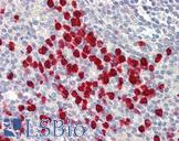 LONP2 / LONP Antibody - Anti-LONP2 / LONP antibody IHC of human spleen. Immunohistochemistry of formalin-fixed, paraffin-embedded tissue after heat-induced antigen retrieval. Antibody dilution 5 ug/ml.