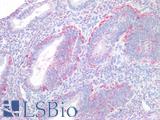 LPAR4 / GPR23 Antibody - Human Uterus Endometrium: Formalin-Fixed, Paraffin-Embedded (FFPE)