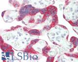 LRAT Antibody - Human Placenta: Formalin-Fixed, Paraffin-Embedded (FFPE)