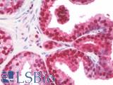 LTA4H / LTA4 Antibody - Anti-LTA4H / LTA4 antibody IHC staining of human prostate. Immunohistochemistry of formalin-fixed, paraffin-embedded tissue after heat-induced antigen retrieval.