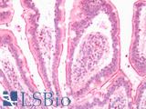 LTB4R2 / BLT2 Antibody - Human Small Intestine: Formalin-Fixed, Paraffin-Embedded (FFPE)
