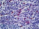 Macrophage Antibody - Anti-Macrophages antibody IHC of human spleen, neutrophils. Immunohistochemistry of formalin-fixed, paraffin-embedded tissue after heat-induced antigen retrieval. Antibody concentration 20 ug/ml.
