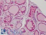 MAD2L1 / MAD2 Antibody - Anti-MAD2L1 antibody IHC of human thyroid. Immunohistochemistry of formalin-fixed, paraffin-embedded tissue after heat-induced antigen retrieval. Antibody concentration 10 ug/ml.