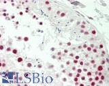 MAGEA9 Antibody - Human Testis: Formalin-Fixed, Paraffin-Embedded (FFPE)