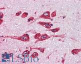 MAOB / Monoamine Oxidase B Antibody - Anti-MAOB antibody IHC of human brain. cortex. Immunohistochemistry of formalin-fixed, paraffin-embedded tissue after heat-induced antigen retrieval. Antibody concentration 5 ug/ml.