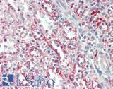 MAP3K11 / MLK3 Antibody - Human Spleen: Formalin-Fixed, Paraffin-Embedded (FFPE)