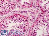 MAP3K5 / ASK1 Antibody - Anti-MAP3K5 / ASK1 antibody IHC of human testis. Immunohistochemistry of formalin-fixed, paraffin-embedded tissue after heat-induced antigen retrieval. Antibody concentration 5 ug/ml.