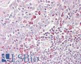 MARCH6 / DOA10 Antibody - Anti-MARCH6 antibody IHC of human tonsil. Immunohistochemistry of formalin-fixed, paraffin-embedded tissue after heat-induced antigen retrieval. Antibody concentration 3.75 ug/ml.