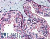 MARCH8 Antibody - Anti-MARCH8 antibody IHC of human prostate. Immunohistochemistry of formalin-fixed, paraffin-embedded tissue after heat-induced antigen retrieval. Antibody concentration 5 ug/ml.