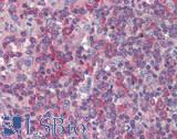 MARCO Antibody - Human Spleen: Formalin-Fixed, Paraffin-Embedded (FFPE)