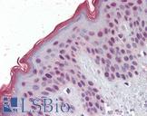 MBD2 Antibody - Anti-MBD2 antibody IHC of human skin. Immunohistochemistry of formalin-fixed, paraffin-embedded tissue after heat-induced antigen retrieval. Antibody concentration 2.5 ug/ml.